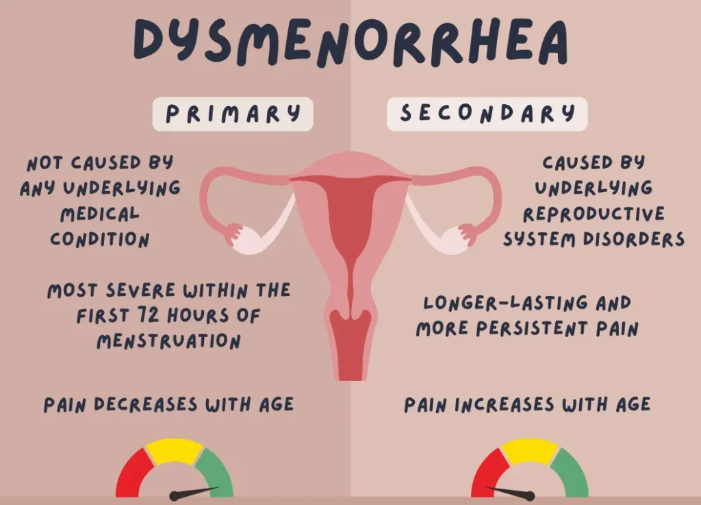 Chinese Medicine Treatment for Dysmenorrhea